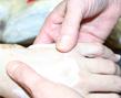 Die Daumen zweier Hände verteilen Salbe auf dem Handrücken eienr dritten Hand